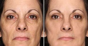 Anti-aging, Top-Rated Anti-Aging Skincare Products Are Available Today! Anti-aging