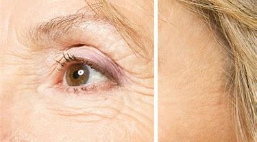 anti-wrinkle skincare products, Top-Rated Anti-Aging Skincare Products Are Available Today! anti-wrinkle skincare products