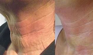 anti-wrinkle skincare products, Top-Rated Anti-Aging Skincare Products Are Available Today! anti-wrinkle skincare products